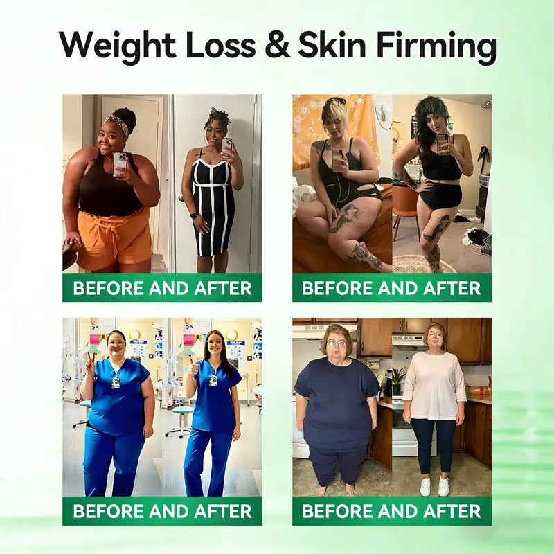 𝑶𝒇𝒇𝒊𝒄𝒊𝒂𝒍 𝑺𝒕𝒐𝒓𝒆 | ✨ Solaroza® 10-in-1 Weight Loss Patch: Boost Metabolism & Burn Fat (NAD+ & Berberine)